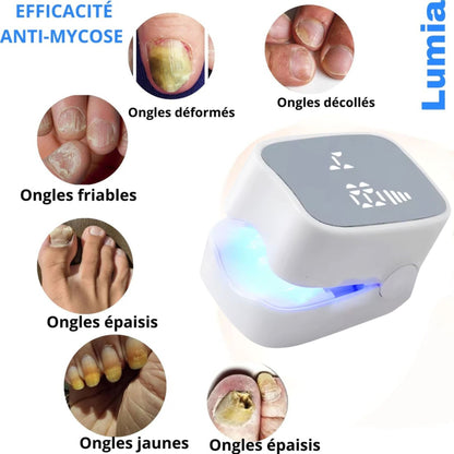 Appareil Anti-Mycose Révolutionnaire