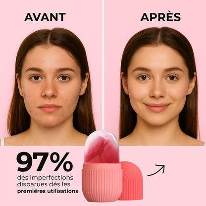 Rouleau à glaçon visage