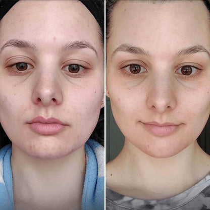 Rouleau à glaçon visage