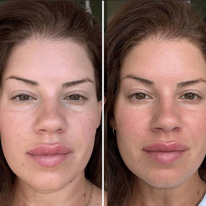 Rouleau à glaçon visage