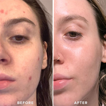 Rouleau à glaçon visage